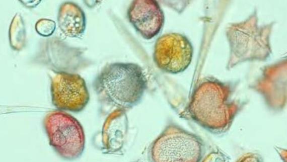 Plankton on the microscope