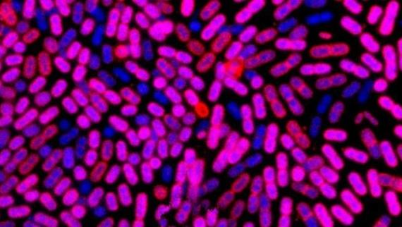 Bacterias ao microscopio con tinción gram (púrpura e azul)