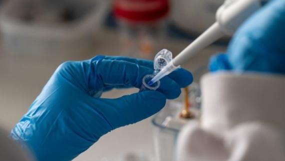Hands with blue gloves taking a sample from an Eppendorf